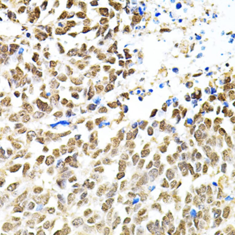 Immunohistochemistry - Anti-PNK/PNKP Antibody (A16877) - Antibodies.com