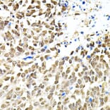 Immunohistochemistry - Anti-PNK/PNKP Antibody (A16877) - Antibodies.com