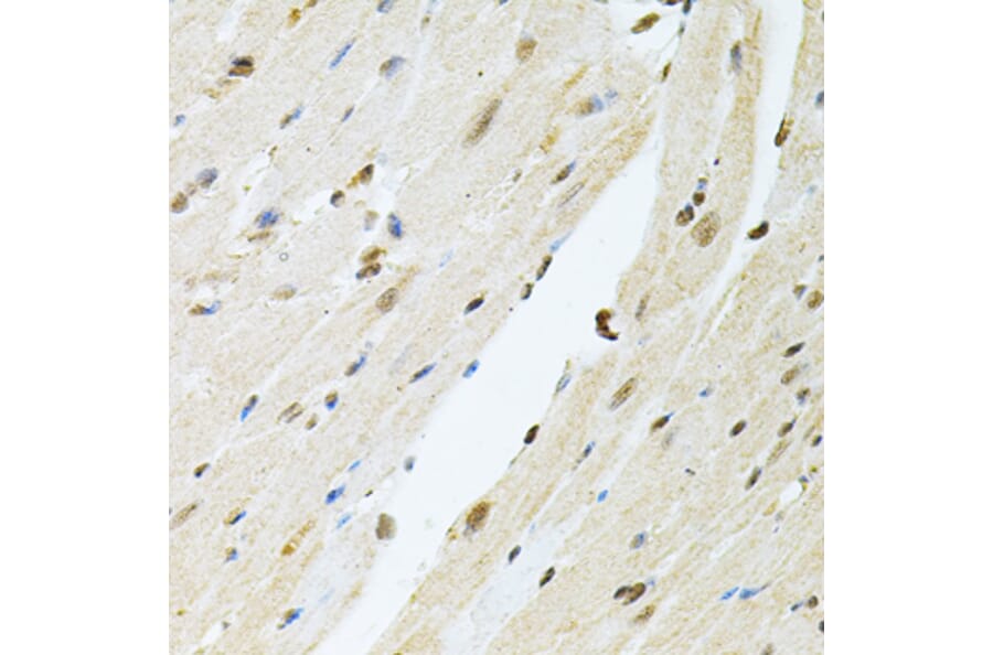 Immunohistochemistry - Anti-PNK/PNKP Antibody (A16877) - Antibodies.com