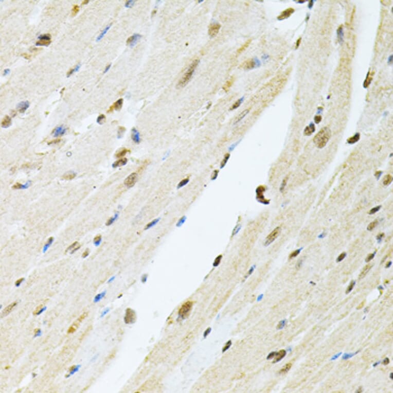 Immunohistochemistry - Anti-PNK/PNKP Antibody (A16877) - Antibodies.com