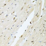 Immunohistochemistry - Anti-PNK/PNKP Antibody (A16877) - Antibodies.com