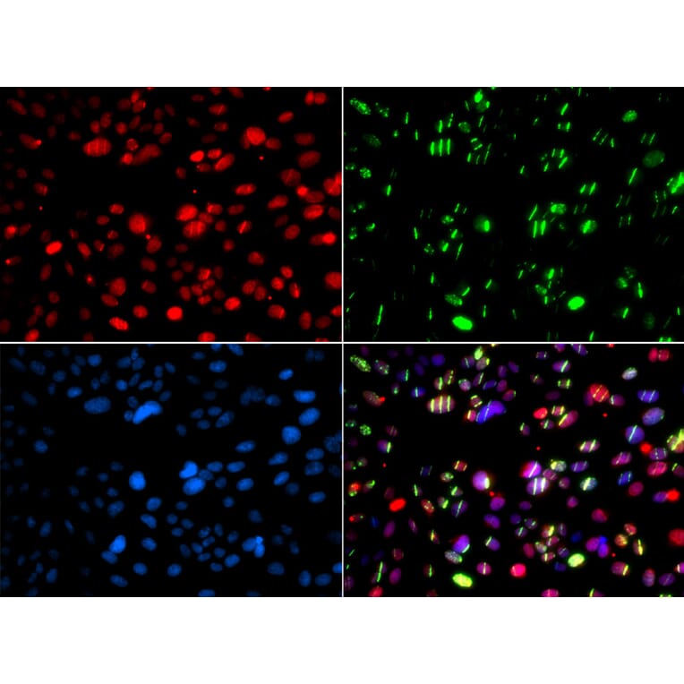 Immunofluorescence - Anti-PNK/PNKP Antibody (A16877) - Antibodies.com