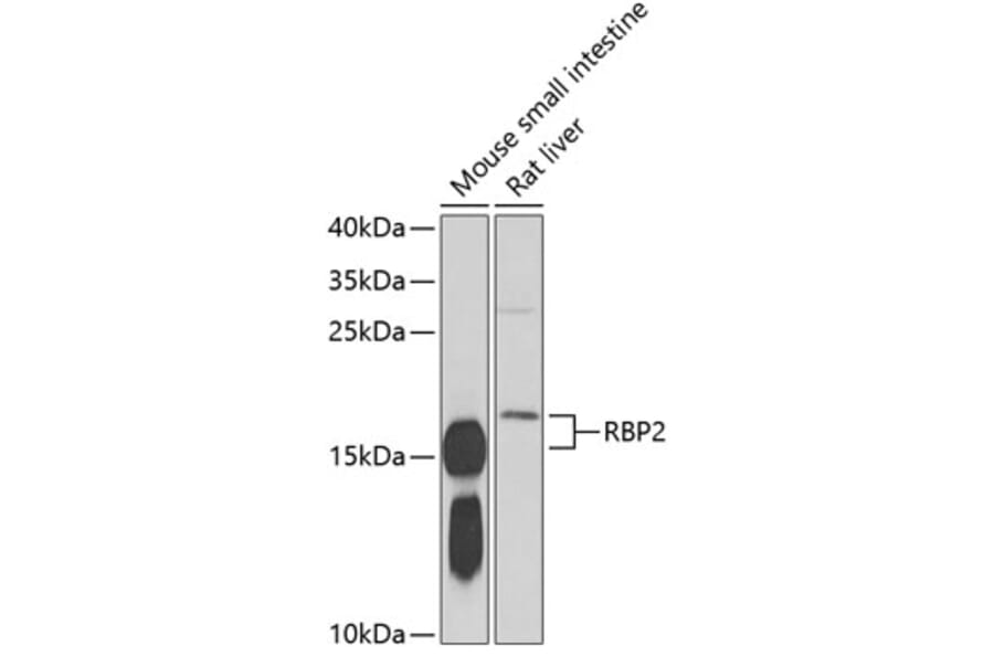 Western Blot - Anti-RBP2 Antibody (A16878) - Antibodies.com