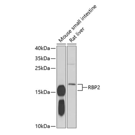 Western Blot - Anti-RBP2 Antibody (A16878) - Antibodies.com
