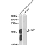 Western Blot - Anti-RBP2 Antibody (A16878) - Antibodies.com