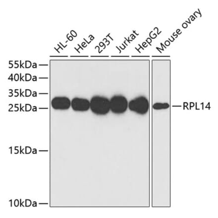 Western Blot - Anti-RPL14 Antibody (A16879) - Antibodies.com