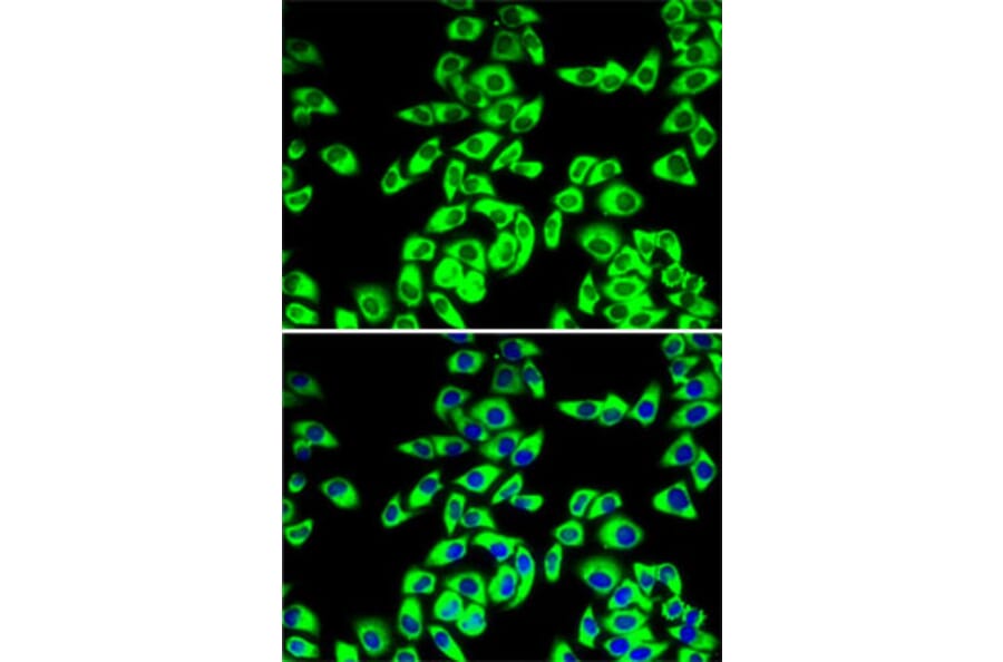 Immunofluorescence - Anti-RPL14 Antibody (A16879) - Antibodies.com