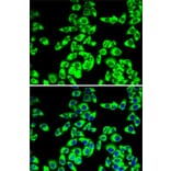 Immunofluorescence - Anti-RPL14 Antibody (A16879) - Antibodies.com
