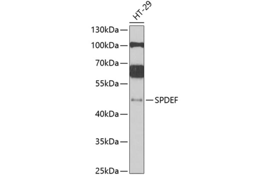 Western Blot - Anti-SPDEF / PSE Antibody (A16881) - Antibodies.com