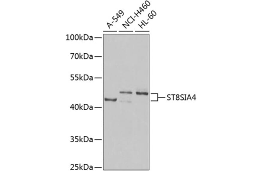Western Blot - Anti-ST8SIA4 Antibody (A16882) - Antibodies.com