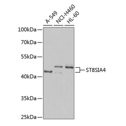 Western Blot - Anti-ST8SIA4 Antibody (A16882) - Antibodies.com