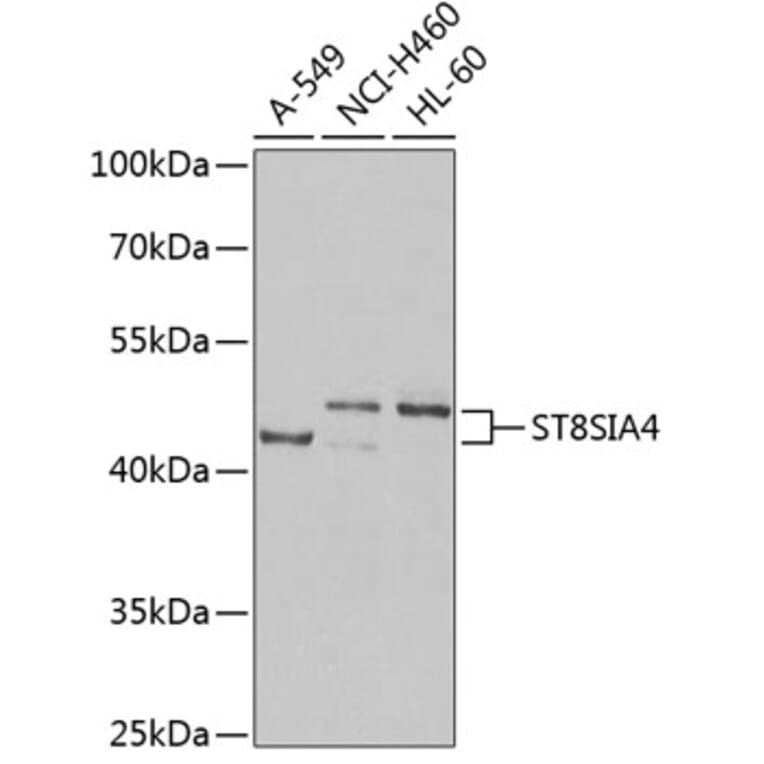 Western Blot - Anti-ST8SIA4 Antibody (A16882) - Antibodies.com