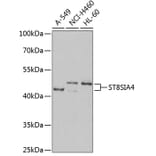Western Blot - Anti-ST8SIA4 Antibody (A16882) - Antibodies.com
