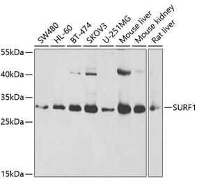 Western Blot - Anti-Surf1 Antibody (A16883) - Antibodies.com