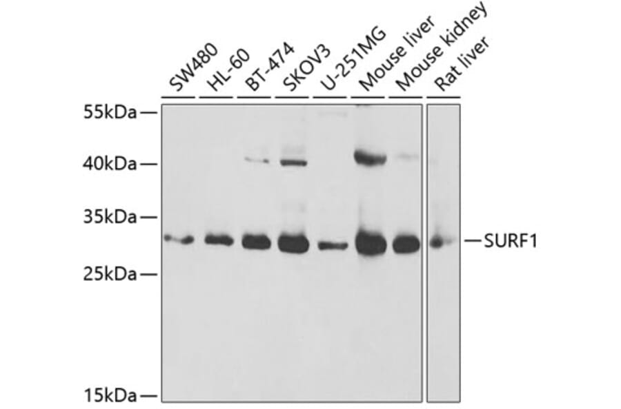 Western Blot - Anti-Surf1 Antibody (A16883) - Antibodies.com