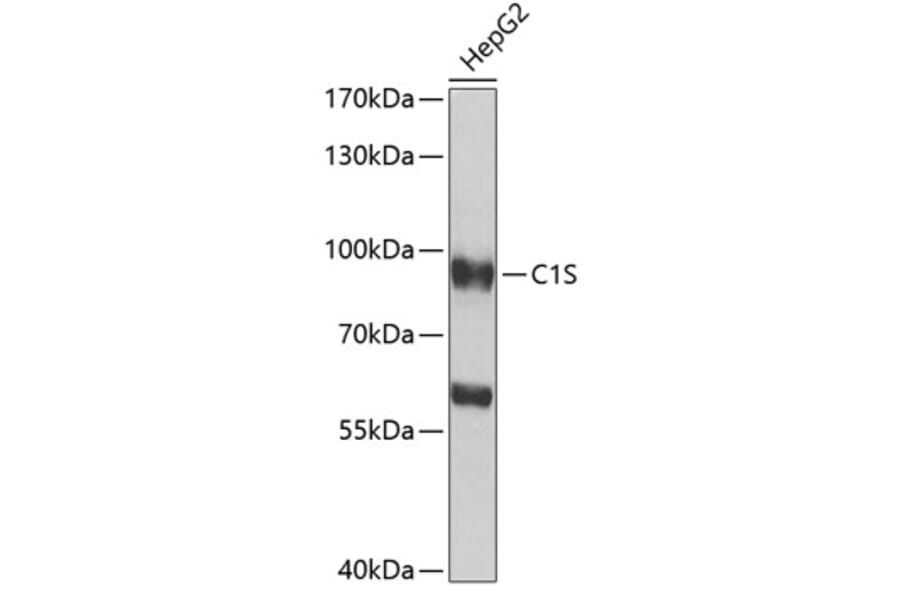 Western Blot - Anti-C1s Antibody (A16887) - Antibodies.com