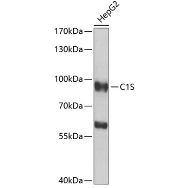 Western Blot - Anti-C1s Antibody (A16887) - Antibodies.com