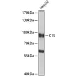 Western Blot - Anti-C1s Antibody (A16887) - Antibodies.com
