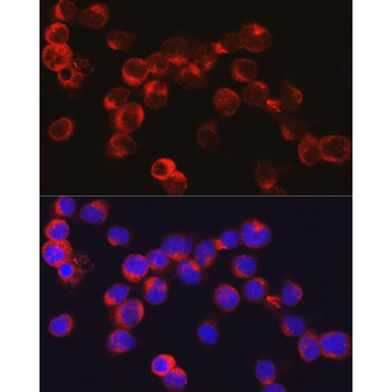 Immunofluorescence - Anti-alpha Defensin 1 Antibody (A16888) - Antibodies.com