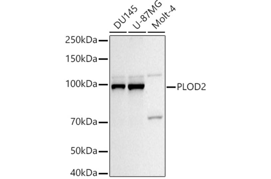 Western Blot - Anti-PLOD2/LH2 Antibody (A16889) - Antibodies.com