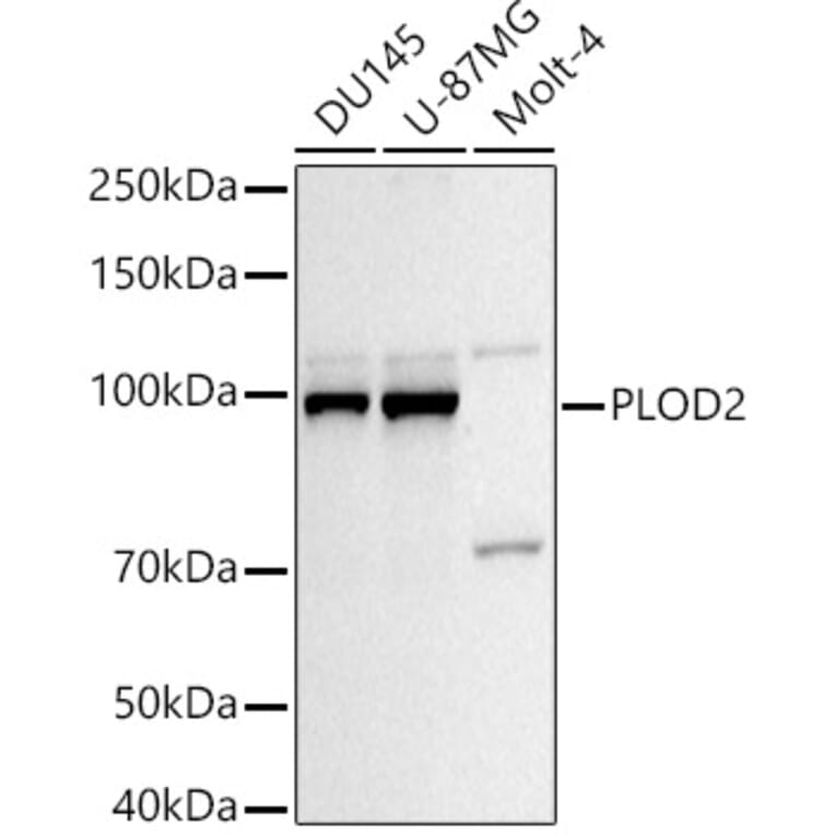 Western Blot - Anti-PLOD2/LH2 Antibody (A16889) - Antibodies.com