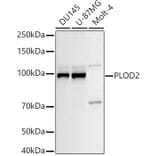 Western Blot - Anti-PLOD2/LH2 Antibody (A16889) - Antibodies.com