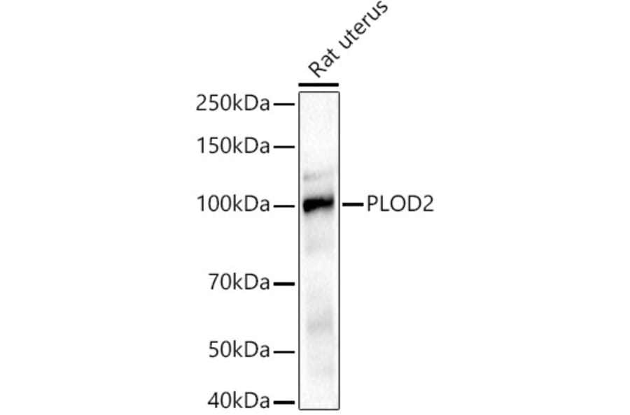 Western Blot - Anti-PLOD2/LH2 Antibody (A16889) - Antibodies.com