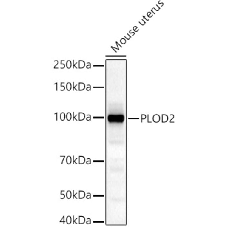 Western Blot - Anti-PLOD2/LH2 Antibody (A16889) - Antibodies.com