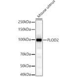 Western Blot - Anti-PLOD2/LH2 Antibody (A16889) - Antibodies.com