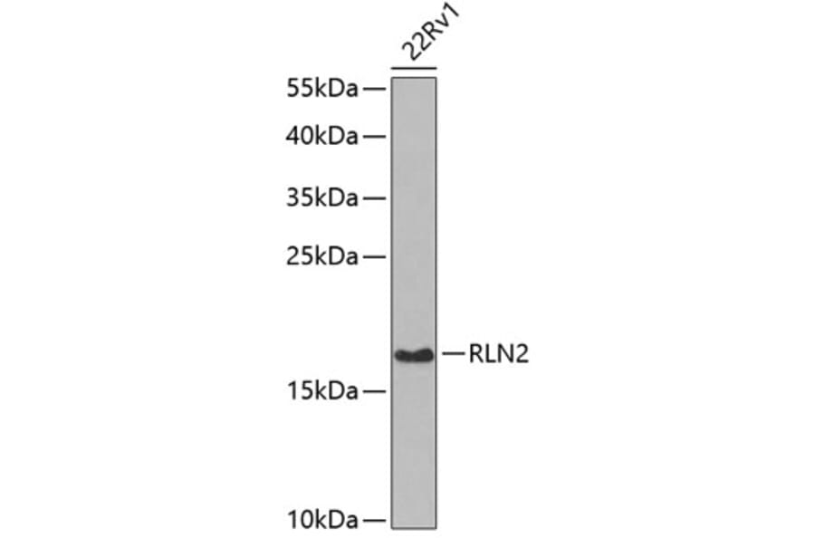 Western Blot - Anti-Relaxin 2/RLN2 Antibody (A16890) - Antibodies.com