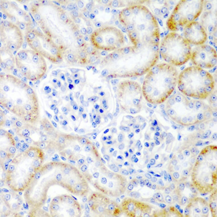 Immunohistochemistry - Anti-Relaxin 2/RLN2 Antibody (A16890) - Antibodies.com