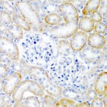 Immunohistochemistry - Anti-Relaxin 2/RLN2 Antibody (A16890) - Antibodies.com