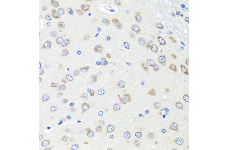 Immunohistochemistry - Anti-PIAS3 Antibody (A16891) - Antibodies.com