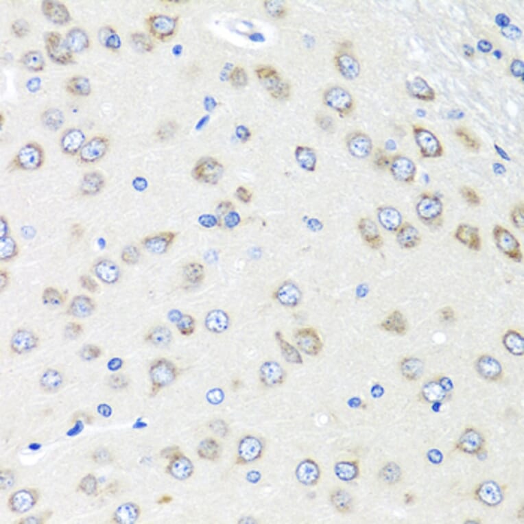 Immunohistochemistry - Anti-PIAS3 Antibody (A16891) - Antibodies.com