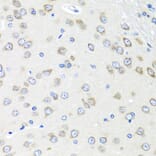 Immunohistochemistry - Anti-PIAS3 Antibody (A16891) - Antibodies.com