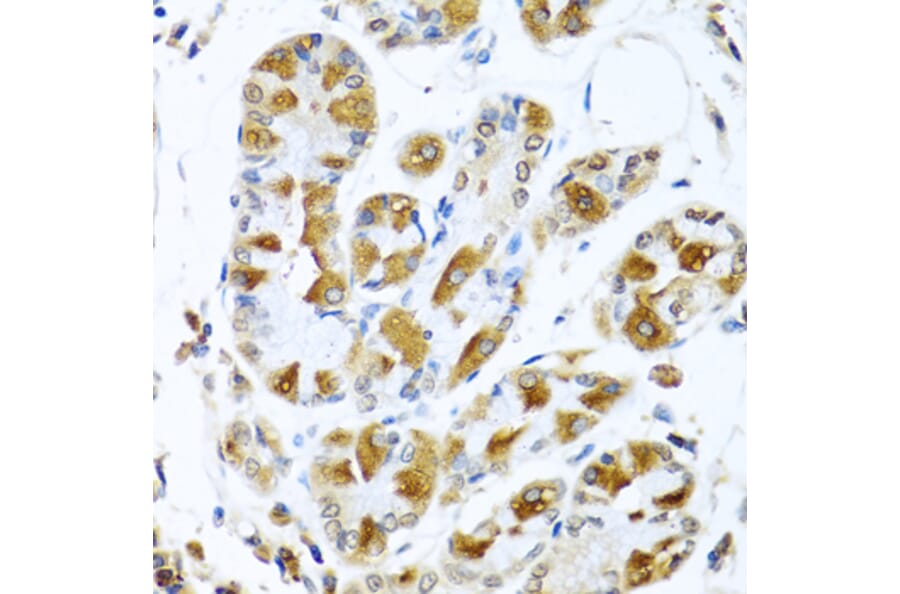 Immunohistochemistry - Anti-PIAS3 Antibody (A16891) - Antibodies.com