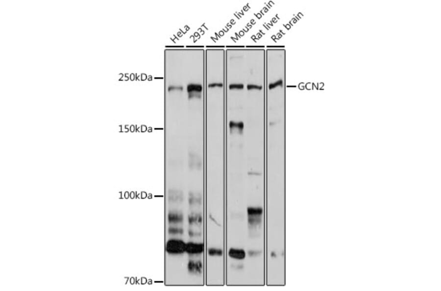 Western Blot - Anti-GCN2 Antibody (A16892) - Antibodies.com