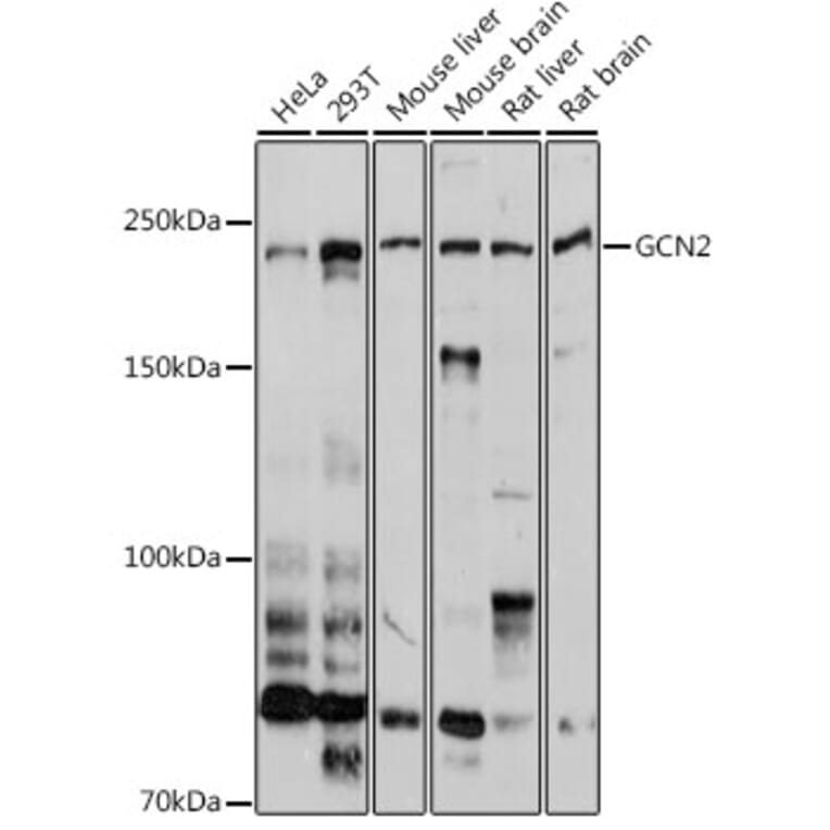 Western Blot - Anti-GCN2 Antibody (A16892) - Antibodies.com