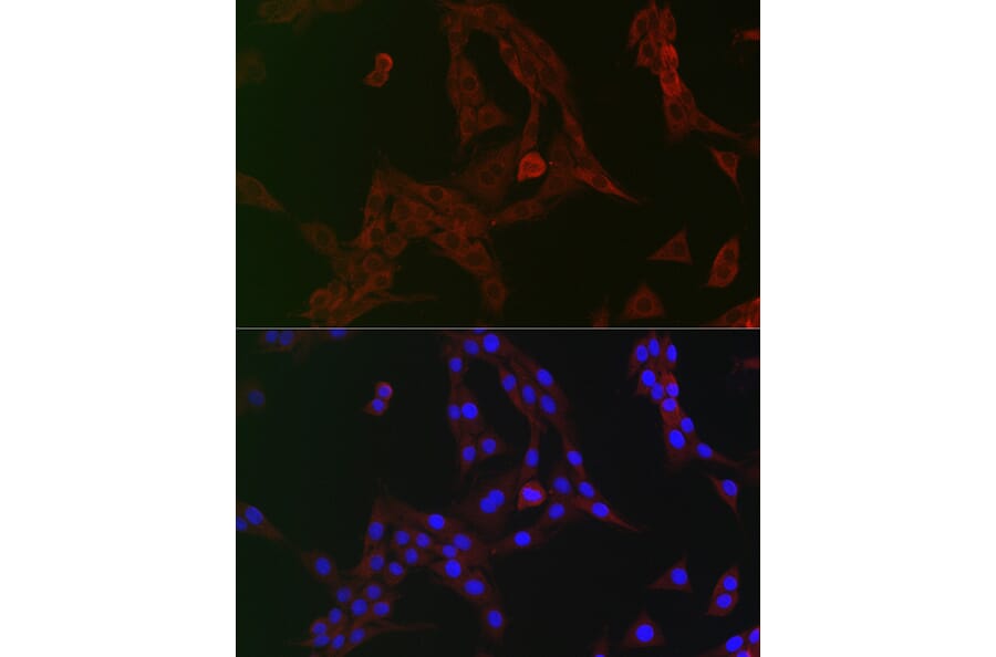 Immunofluorescence - Anti-GCN2 Antibody (A16892) - Antibodies.com
