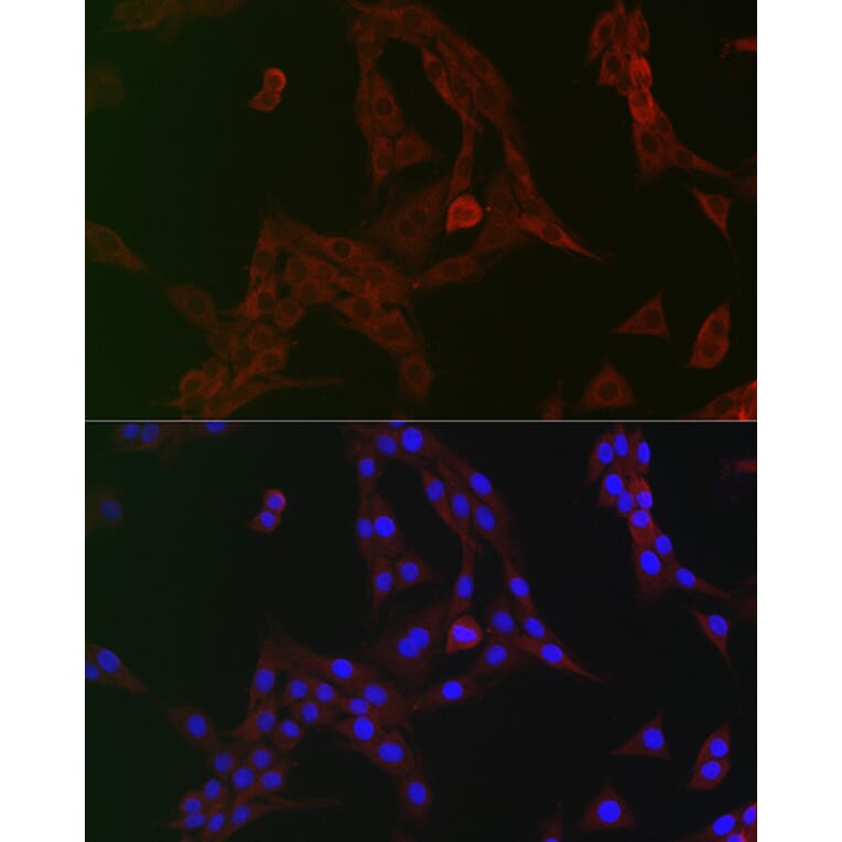 Immunofluorescence - Anti-GCN2 Antibody (A16892) - Antibodies.com