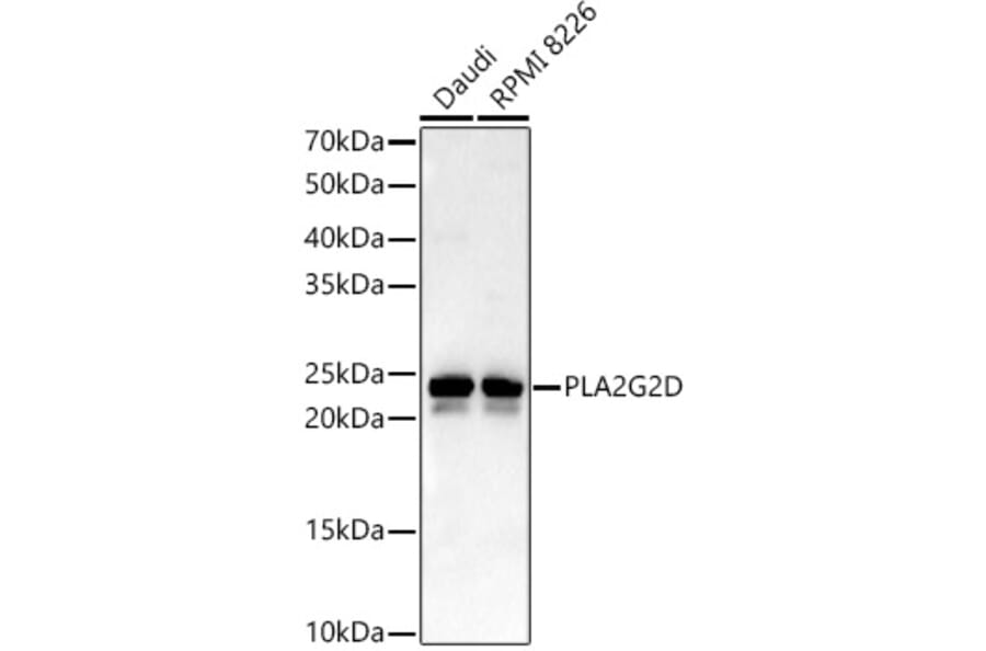 Western Blot - Anti-SPLASH Antibody (A16893) - Antibodies.com