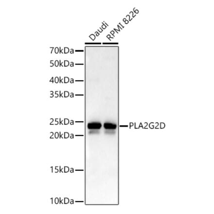 Western Blot - Anti-SPLASH Antibody (A16893) - Antibodies.com
