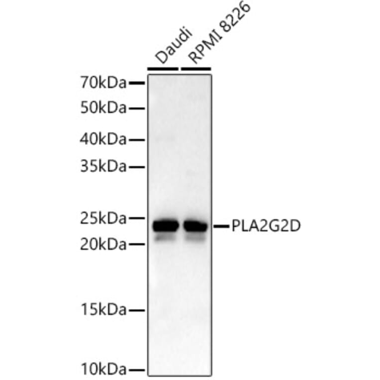 Western Blot - Anti-SPLASH Antibody (A16893) - Antibodies.com
