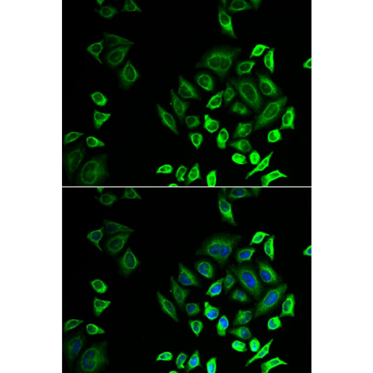 Immunofluorescence - Anti-SPLASH Antibody (A16893) - Antibodies.com
