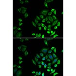 Immunofluorescence - Anti-SPLASH Antibody (A16893) - Antibodies.com