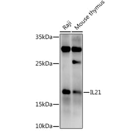 Western Blot - Anti-IL-21 Antibody (A16894) - Antibodies.com
