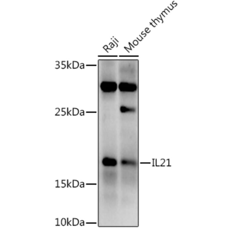 Western Blot - Anti-IL-21 Antibody (A16894) - Antibodies.com