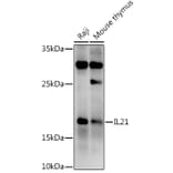 Western Blot - Anti-IL-21 Antibody (A16894) - Antibodies.com