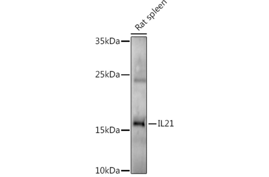 Western Blot - Anti-IL-21 Antibody (A16894) - Antibodies.com