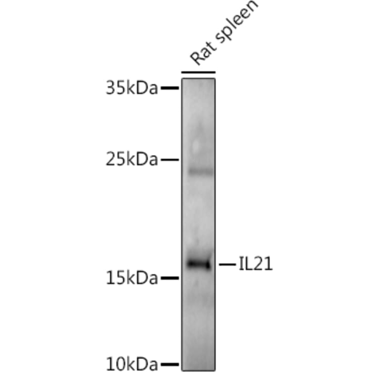 Western Blot - Anti-IL-21 Antibody (A16894) - Antibodies.com